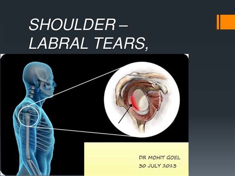 anterior posterior labral tear test|posterior labral tear in shoulder.